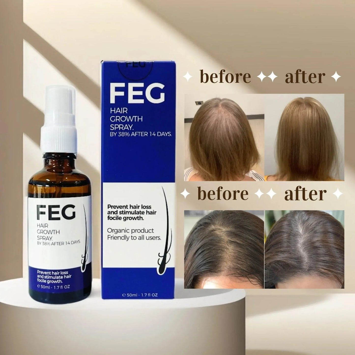 FEG PLUS Hair & Beard Regrowth Spray – Anti Hair Loss Formula with Minoxidil, Redensyl & Natural Extracts (50ml)( Free Delivery All Over Pakistan )