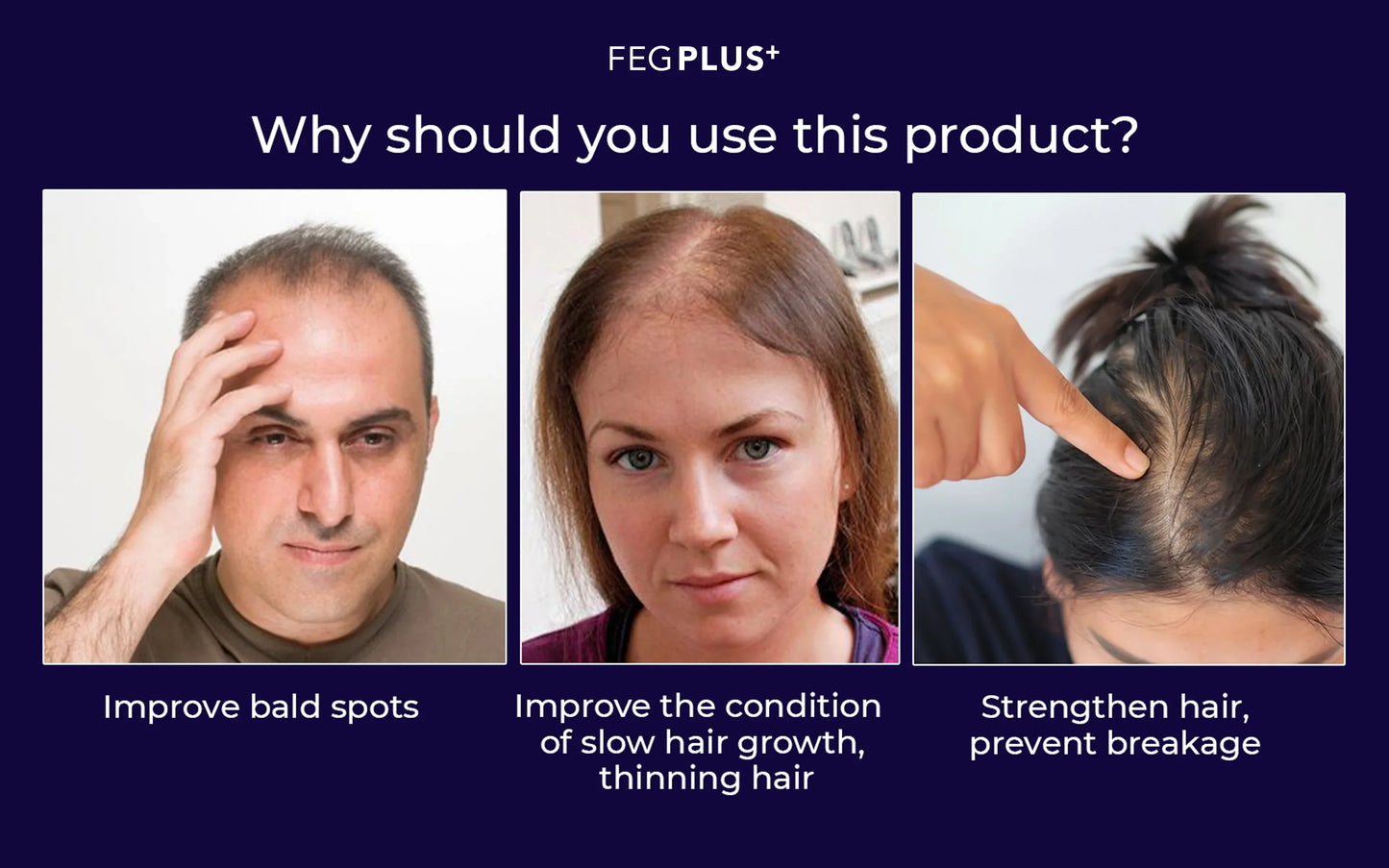 FEG PLUS Hair & Beard Regrowth Spray – Anti Hair Loss Formula with Minoxidil, Redensyl & Natural Extracts (50ml)( Free Delivery All Over Pakistan )