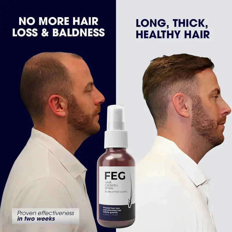 FEG PLUS Hair & Beard Regrowth Spray – Anti Hair Loss Formula with Minoxidil, Redensyl & Natural Extracts (50ml)( Free Delivery All Over Pakistan )